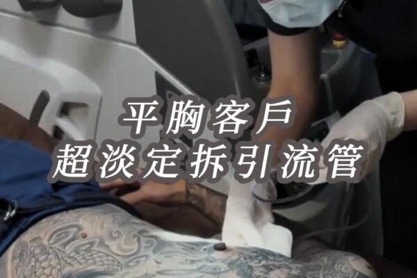 拆引流管超淡定！平胸手術放置引流管真的比較安全嗎？